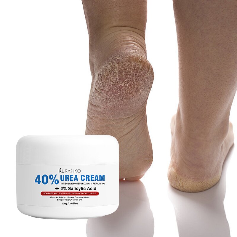 Foot Cream Manufacturer - Anti-Cracking Urea 40% - Dry Cracked Skin Callus Remover Hand Foot Care OEM