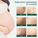 Stretch Mark Oil Manufacturer - Postpartum Repair Massage Oil - Scar Removal Body Moisturizing Treatment