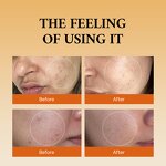 Skincare Set Manufacturer - Kojic Acid Vitamin C 5 Pcs - Dark Spot Removal Whitening Black Skin Care