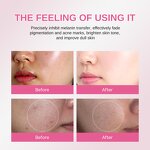 Skincare Set Manufacturer - TXA Niacinamide 4 Pcs - Brightening Blemish-Clearing Korean Skincare Routine