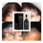 Beard Growth Kit Manufacturer - Derma Roller Biotin Serum - Hair Regrowth Thinning Hair Loss Treatment Private Label