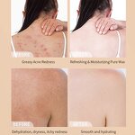 Liquid Soap Manufacturer - Adults' Sulfur Mite-Cleaning Herbal Olive Oil Whitening Slimming Antiseptic Anti-Acne Skin Care