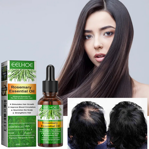 Hair Essential Oil Manufacturer - Eelhoe Rosemary Herbal Infused Scalp Nourishing Dry Hair Anti-Hair Loss Regrowth