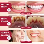 Herbal Probiotic Toothpaste Manufacturer - Gentle Stain Removal Fresh Breath Teeth Whitening Home Oral Care