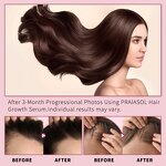 Hair Oil Manufacturer - Private Label Strengthening Scalp Repair Regrowth Anti-Hair Loss Treatment Formula