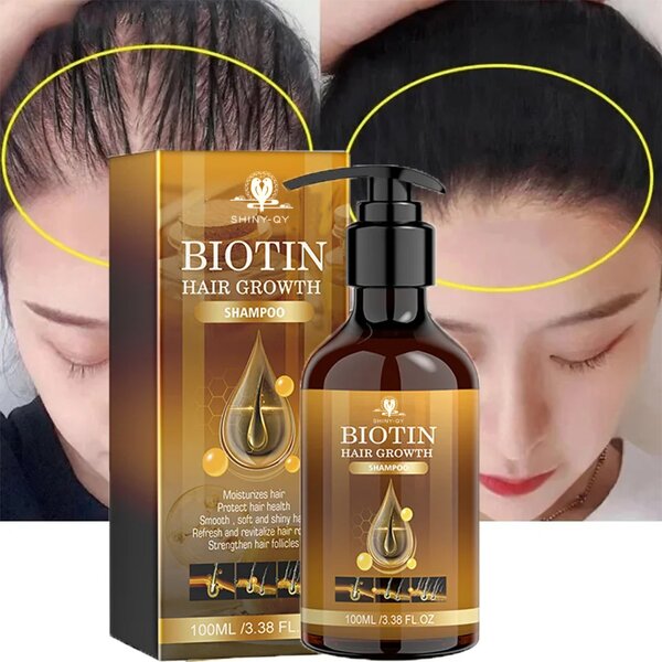 Biotin Shampoo Manufacturer - Private Label Natural Strengthen Anti-Hair Loss Hair Growth Shampoo