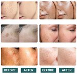 Face Cream Manufacturer - Anti Pigmentation Aging Brightening Lightening Melasma Removal Dark Spot Corrector