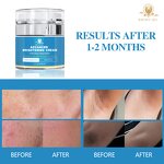 Dark Spot Cream Manufacturer - Private Label Nourishing Hydrating Anti-Aging Bleaching Brightening Formula