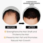 Hair Growth Oil Manufacturer - Private Label Advanced Anti-Hair Loss Treatment Scalp Regrowth Repair Formula