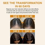 Hair Growth Oil Manufacturer - Private Label Advanced Anti-Hair Loss Treatment Scalp Regrowth Repair Formula