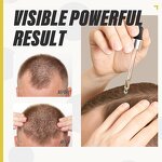 Hair Growth Serum Manufacturer - Natural Ingredients Treatment Scalp Regrowth Oil Biotin Hair Growth Formula