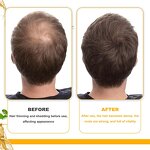 Biotin Shampoo Manufacturer - Private Label Natural Strengthen Anti-Hair Loss Hair Growth Shampoo