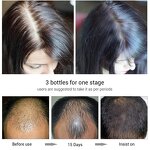 Biotin Shampoo Manufacturer - Private Label Natural Strengthen Anti-Hair Loss Hair Growth Shampoo