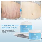 Stretch Mark Cream Manufacturer - Private Label Natural Non-Irritating Fast Acting Smooth Skin Repair Formula