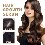 Hair Growth Oil Manufacturer - 100% Natural Angelica Ginseng Ginger Repair Regrowth Anti-Hair Loss Treatment