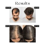 Hair Growth Oil Manufacturer - Private Label Advanced Anti-Hair Loss Treatment Scalp Regrowth Repair Formula