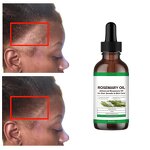 Hair Growth Oil Manufacturer - Private Label Scalp Care Anti-Hair Loss Rosemary Oil for Hair Growth