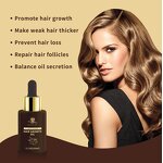 Hair Growth Serum Manufacturer - Custom Logo Biotin Scalp Care Anti-Hair Loss Ginseng Regrowth Treatment Oil