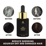 Hair Growth Oil Manufacturer - 100% Natural Angelica Ginseng Ginger Repair Regrowth Anti-Hair Loss Treatment