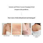 Body Lotion Manufacturer - Hyaluronic Acid Rice Anti-Aging Firming Lifting Rejuvenation Moisturizing Formula