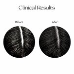 Herbal Hair Serum Manufacturer - Private Label Regrowth Oil Rice Water Treatment Scalp Herbal Growth Formula