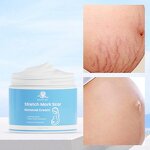 Stretch Mark Cream Manufacturer - Private Label Natural Non-Irritating Fast Acting Smooth Skin Repair Formula