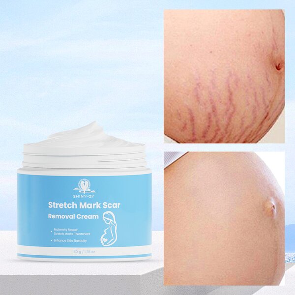 Stretch Mark Cream Manufacturer - Private Label Natural Non-Irritating Fast Acting Smooth Skin Repair Formula