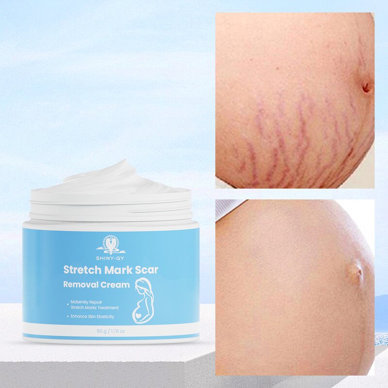 Stretch Mark Cream Manufacturer - Private Label Natural Non-Irritating Fast Acting Smooth Skin Repair Formula