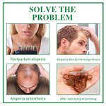 Hair Growth Oil Manufacturer - Private Label Scalp Care Anti-Hair Loss Rosemary Oil for Hair Growth