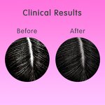 Hair Growth Oil Manufacturer - Private Label Advanced Anti-Hair Loss Fast Regrowth Hair Growth Serum