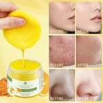 Cleansing Pads Manufacturer - Hot Selling Low Moq Private Label Dark Spots Remover Kojic Acid Turmeric Cleansing Pads
