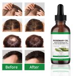 Hair Growth Oil Manufacturer - Private Label Scalp Care Anti-Hair Loss Rosemary Oil for Hair Growth