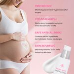 Anti-Stretch Mark Cream Manufacturer - Custom Organic Anti Stretch Mark Wrinkle Beauty Scar Removal Cream