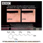 Eye Cream Manufacturer - Customized Natural Anti Wrinkle Collagen Caffeine Retinol Eye Treatment Formula