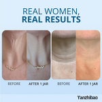 Cream Manufacturer - Tighten Lift Neck Face for Sagging Skin Tone Improvement Fine Lines Reduction