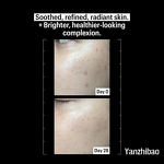 Face Serum Manufacturer - 20% Vitamin C 1oz for Uneven Skin Tone Dark Spots Radiant Glow