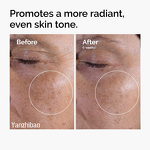 Toner Manufacturer - 7% Glycolic Acid 3.38oz for Exfoliating Brightening Skin Texture Uneven Tone Improvement