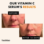 Facial Serum Manufacturer - Powerful Antioxidant with Vitamin C for Dull Skin Dark Spots Anti-Aging Brightening