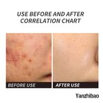 Face Serum Manufacturer - InStock 10% Niacinamide + 1% Zinc 30ml Organic Acne Control Skin Lightening