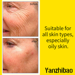 Facial Oil Manufacturer - Bakuchiol Rosehip Plant-Based with Squalane for Oily Skin Collagen Boosting Hydrating