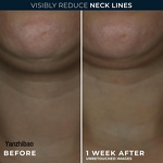 Cream Manufacturer - Neck with Hyaluronic Acid Advanced Retinol for Neck Lines Tightening Lift Facial Moisturizer