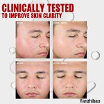 Toner Manufacturer - Blemish Clearing 2% Salicylic Acid for Acne Treatment Non-Stripping Soothing Skin Care