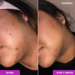 Facial Serum Manufacturer - Discoloration Correcting with Tranexamic Acid & Niacinamide for Dark Spots