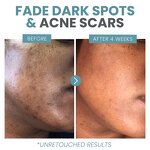 Face Serum Manufacturer - Vitamin C + Hyaluronic Acid 1oz for Dull Uneven Textured Skin Brightening Anti-Aging