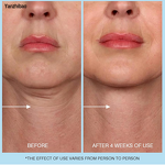 Moisturizer Manufacturer - 3-in-1 Hyaluronic Acid Retinol for Face Neck Chest Fine Lines Dullness Reduction Caffeine