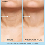 Moisturizer Manufacturer - 3-in-1 Hyaluronic Acid Retinol for Face Neck Chest Fine Lines Dullness Reduction Caffeine