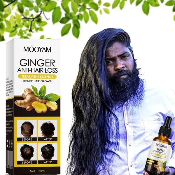 Hair Care Serum Manufacturer - Ginger Anti-Hair Loss for Nourishing Moisturizing Smooth 30ml MOOYAM