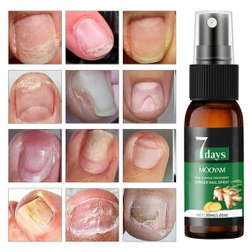 Nail Treatment Spray Manufacturer - 7 Days Nail Fungus for Bacteria Repair 30ml Customized OEM MOOYAM