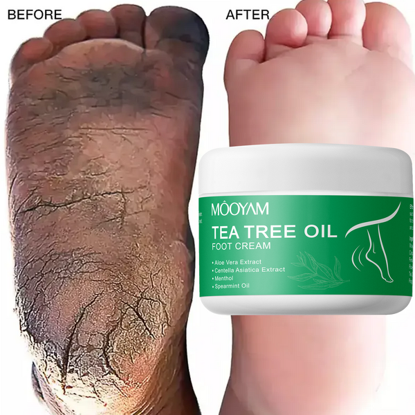 Foot Cream Manufacturer - Tea Tree Oil for Dry Skin Calluses Softening 250g OEM Wholesale Private Label MOOYAM