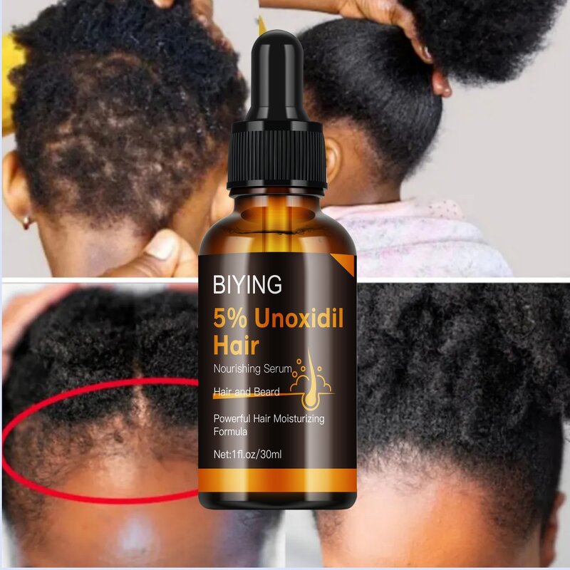 Hair Care Serum Manufacturer - 5% Unoxidil for Beard Hair Moisturizing Smooth 30ml MOOYAM